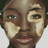 Vitiligo Girl Face Art Diamond Paintings